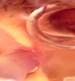 哥們憋壞瞭猛插靚妞屁眼精液像流膿溢出1