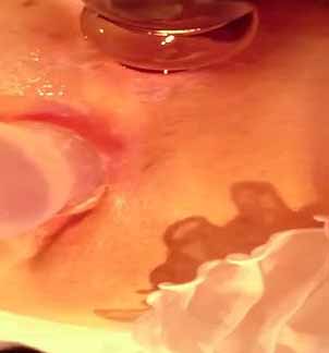 哥們憋壞瞭猛插靚妞屁眼精液像流膿溢出4